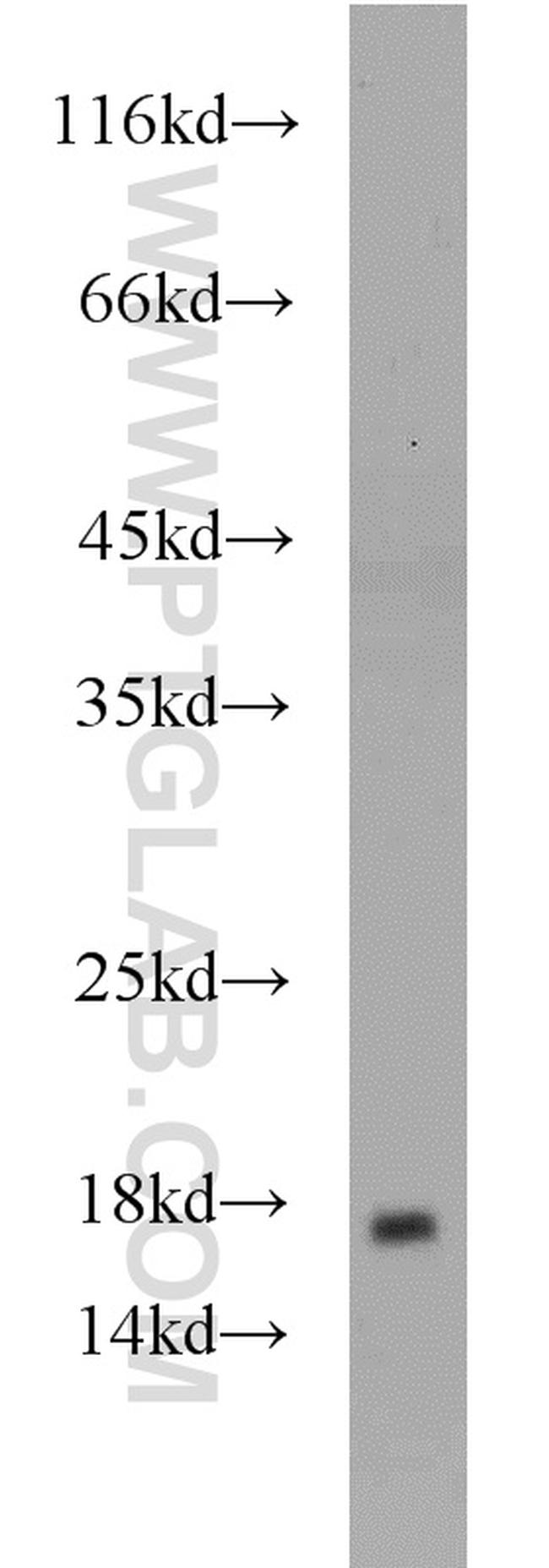 Cofilin 2 Antibody in Western Blot (WB)