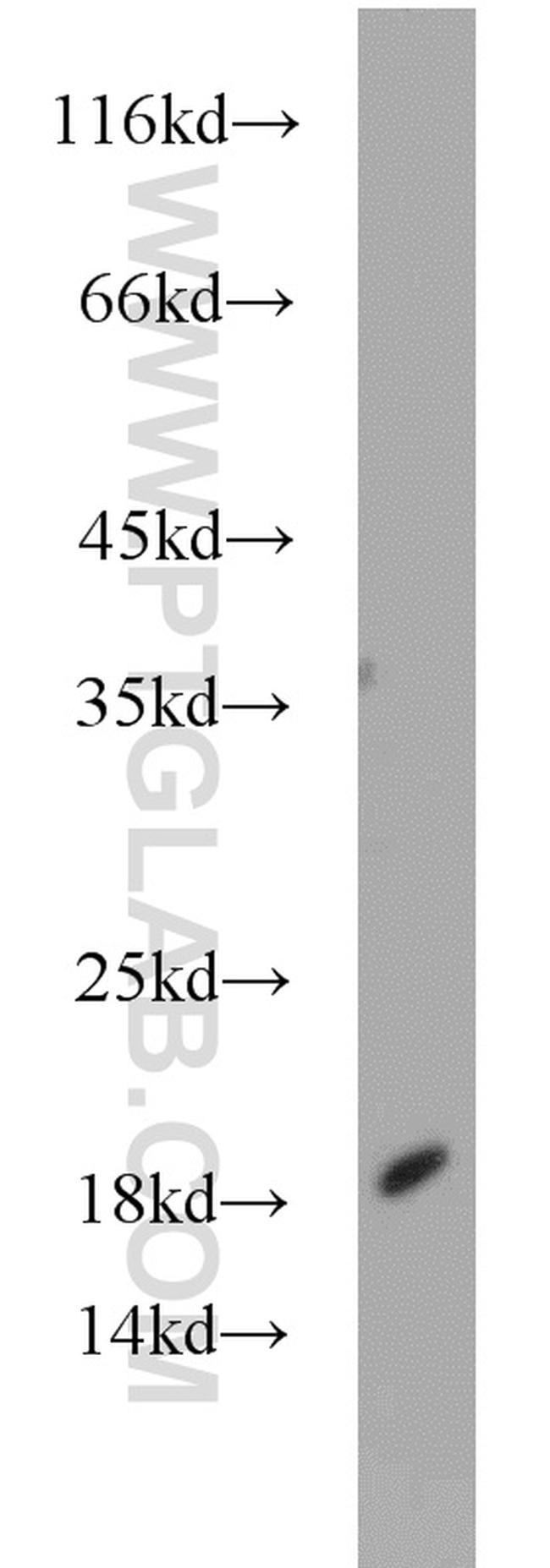 Cofilin 2 Antibody in Western Blot (WB)