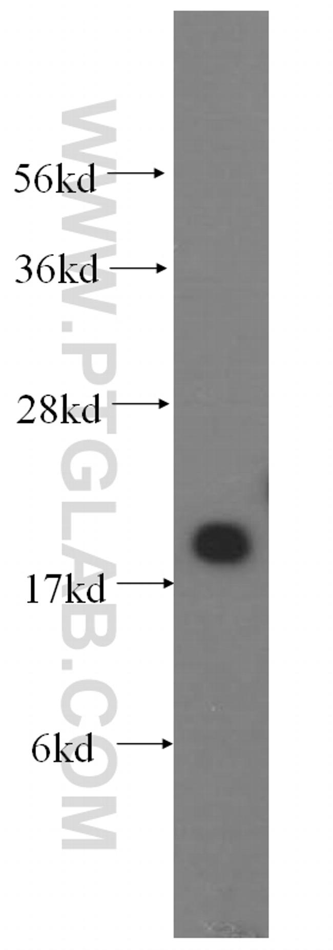 Cofilin 2 Antibody in Western Blot (WB)