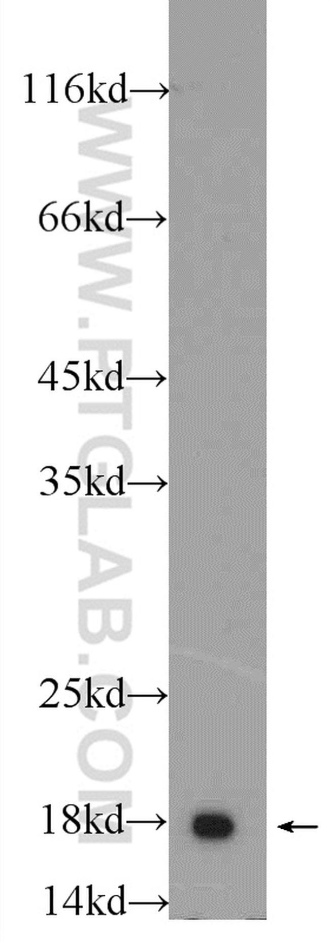 Cofilin 2 Antibody in Western Blot (WB)