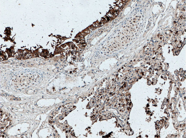 SFTPA1 Antibody in Immunohistochemistry (Paraffin) (IHC (P))