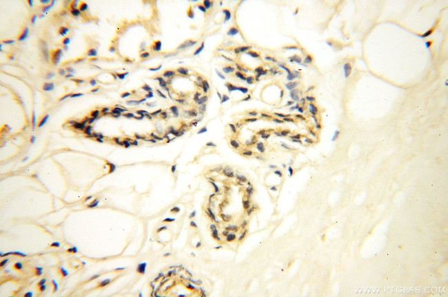 SFTPA1 Antibody in Immunohistochemistry (Paraffin) (IHC (P))