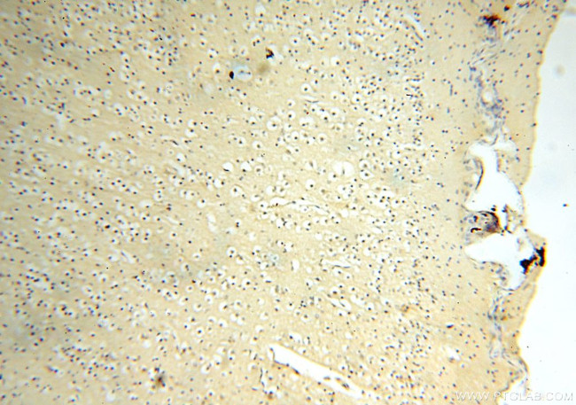 SFTPA1 Antibody in Immunohistochemistry (Paraffin) (IHC (P))