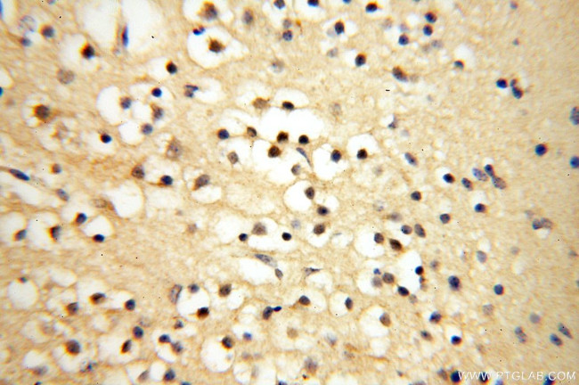 SFTPA1 Antibody in Immunohistochemistry (Paraffin) (IHC (P))