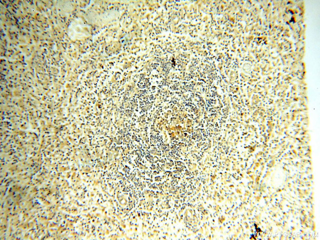 SFTPA1 Antibody in Immunohistochemistry (Paraffin) (IHC (P))