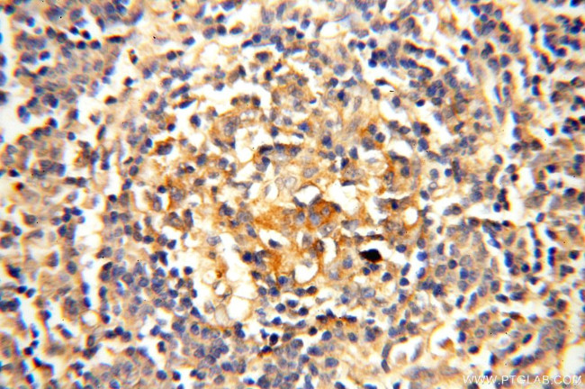 SFTPA1 Antibody in Immunohistochemistry (Paraffin) (IHC (P))