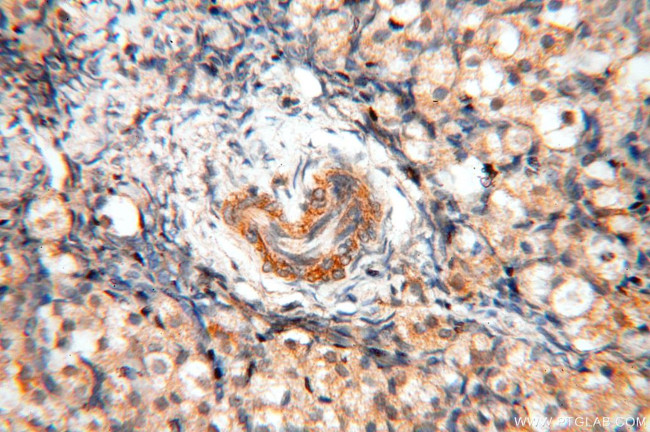 SFTPA1 Antibody in Immunohistochemistry (Paraffin) (IHC (P))