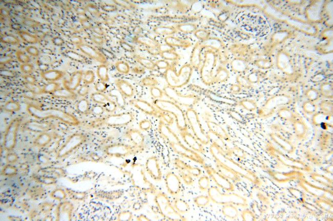 SFTPA1 Antibody in Immunohistochemistry (Paraffin) (IHC (P))