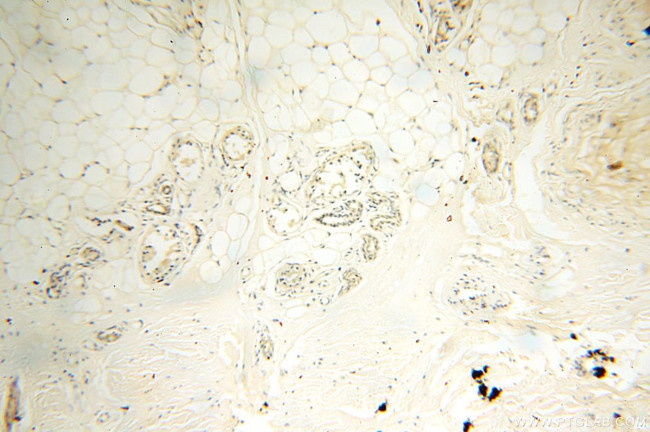 SFTPA1 Antibody in Immunohistochemistry (Paraffin) (IHC (P))