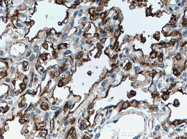 SFTPA1 Antibody in Immunohistochemistry (Paraffin) (IHC (P))