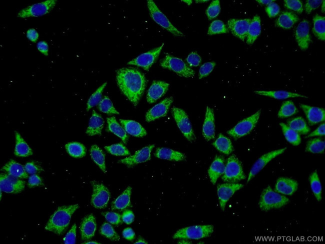 SERPINA10 Antibody in Immunocytochemistry (ICC/IF)