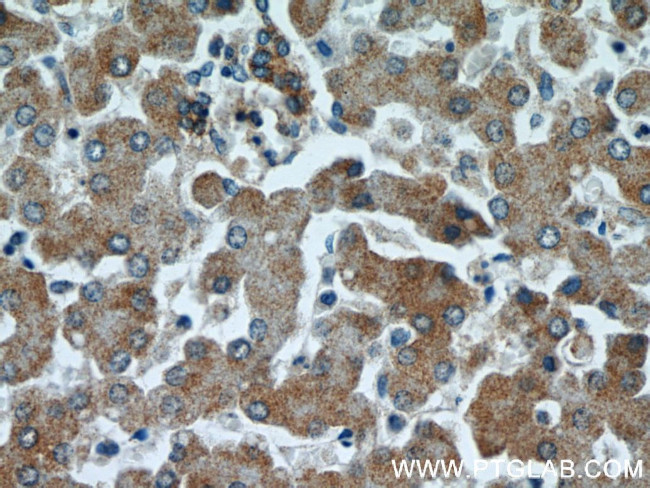 SERPINA10 Antibody in Immunohistochemistry (Paraffin) (IHC (P))