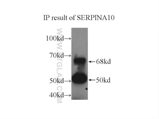 SERPINA10 Antibody in Immunoprecipitation (IP)