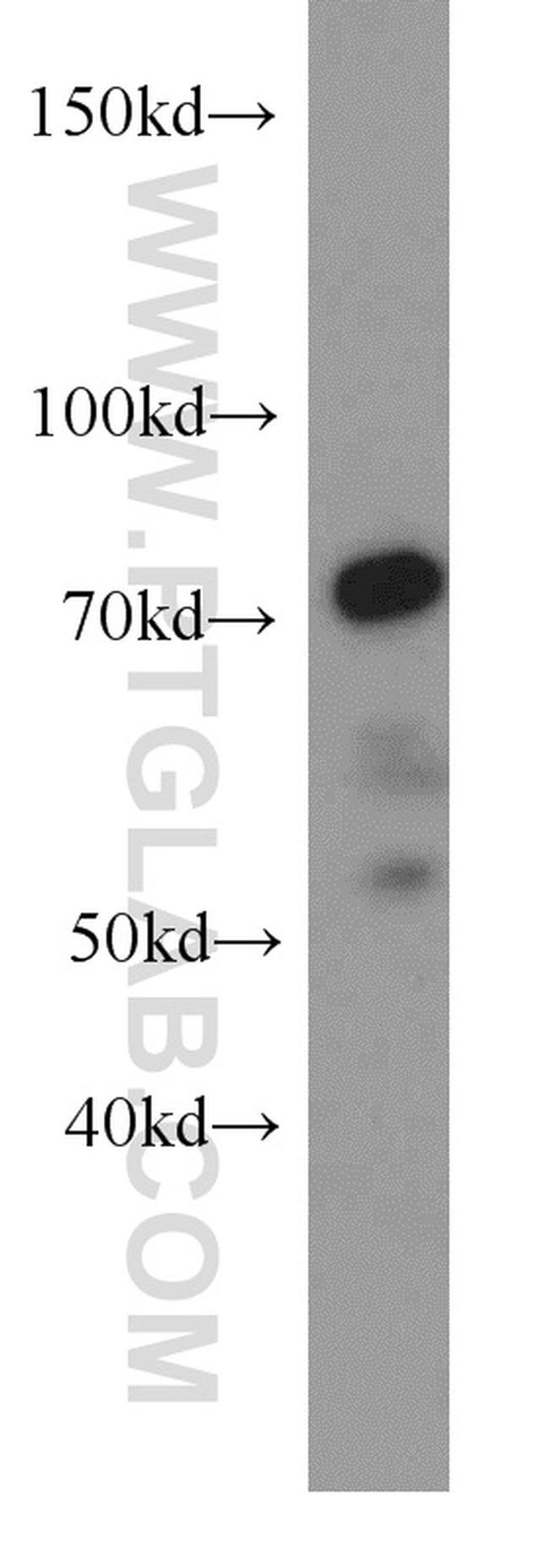 SERPINA10 Antibody in Western Blot (WB)