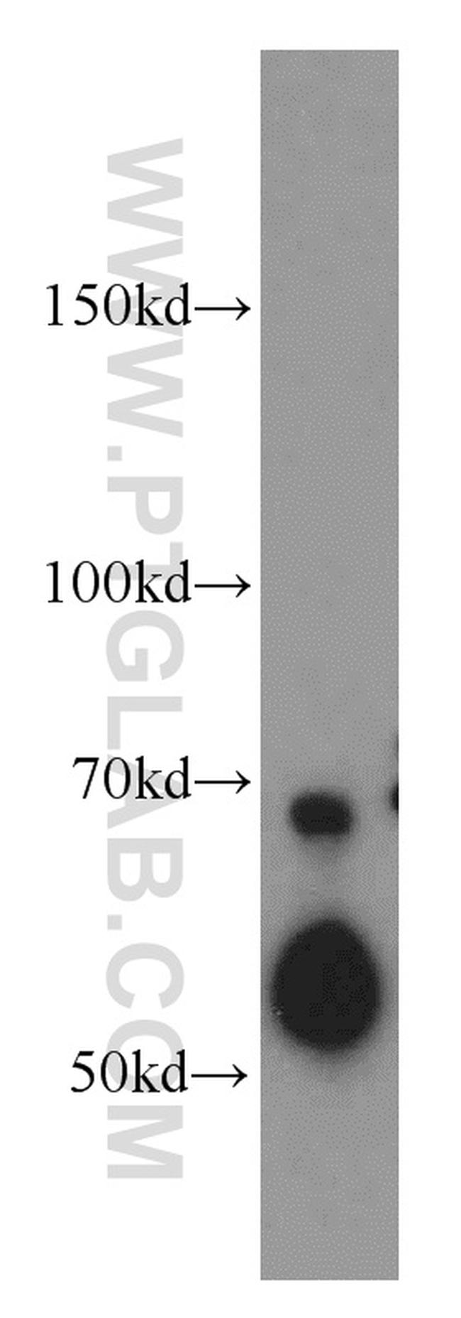 SERPINA10 Antibody in Western Blot (WB)