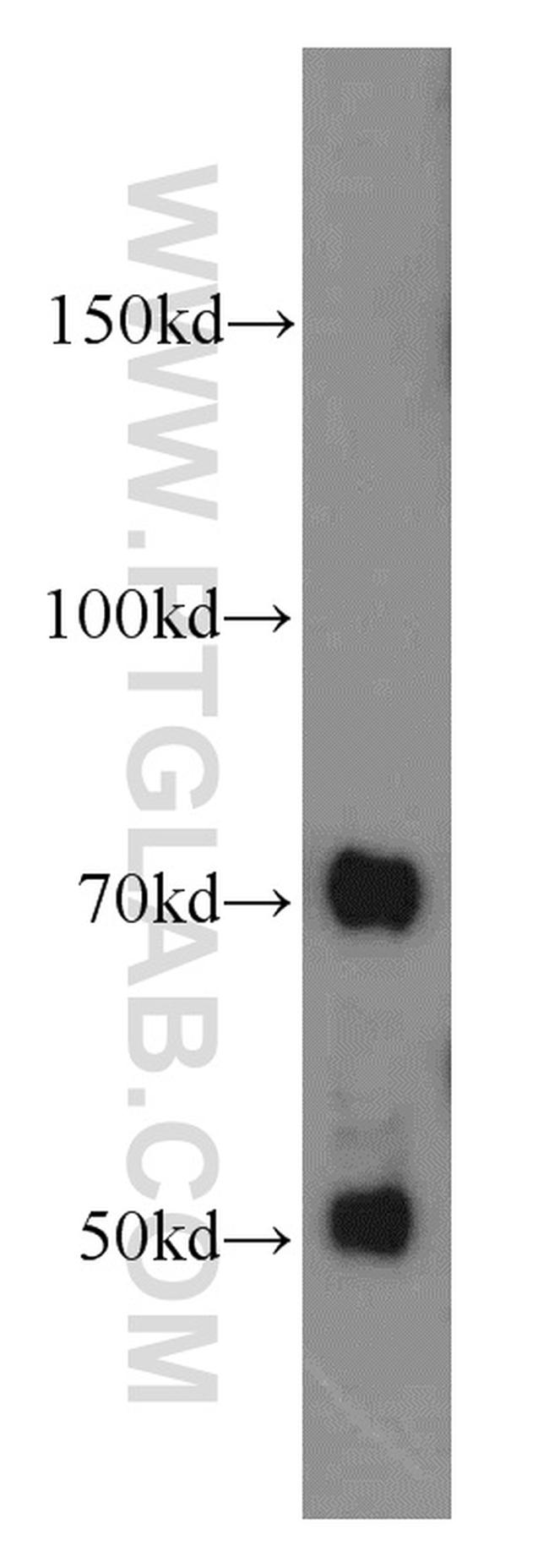 SERPINA10 Antibody in Western Blot (WB)