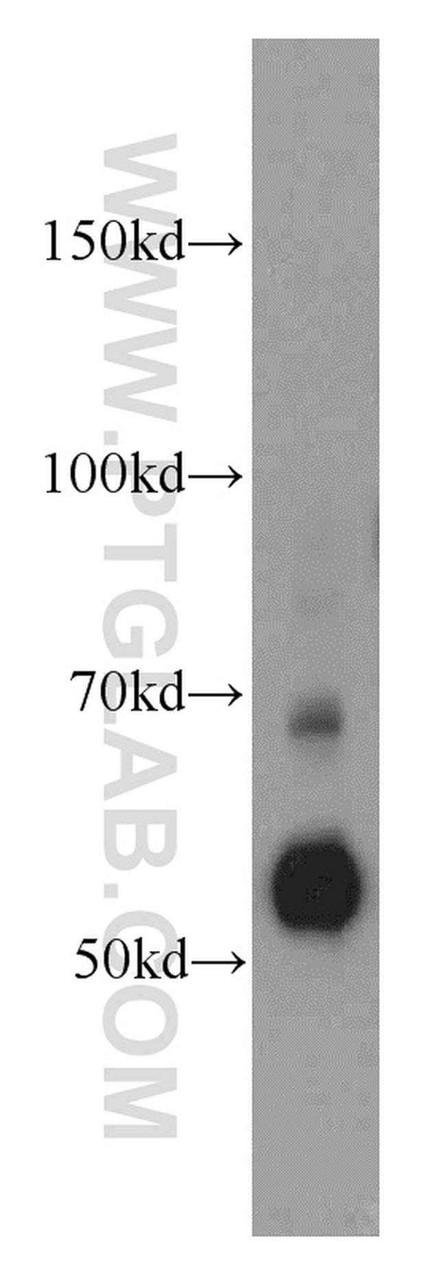 SERPINA10 Antibody in Western Blot (WB)