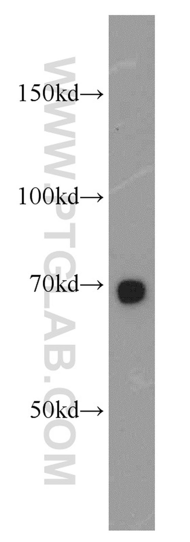 SERPINA10 Antibody in Western Blot (WB)