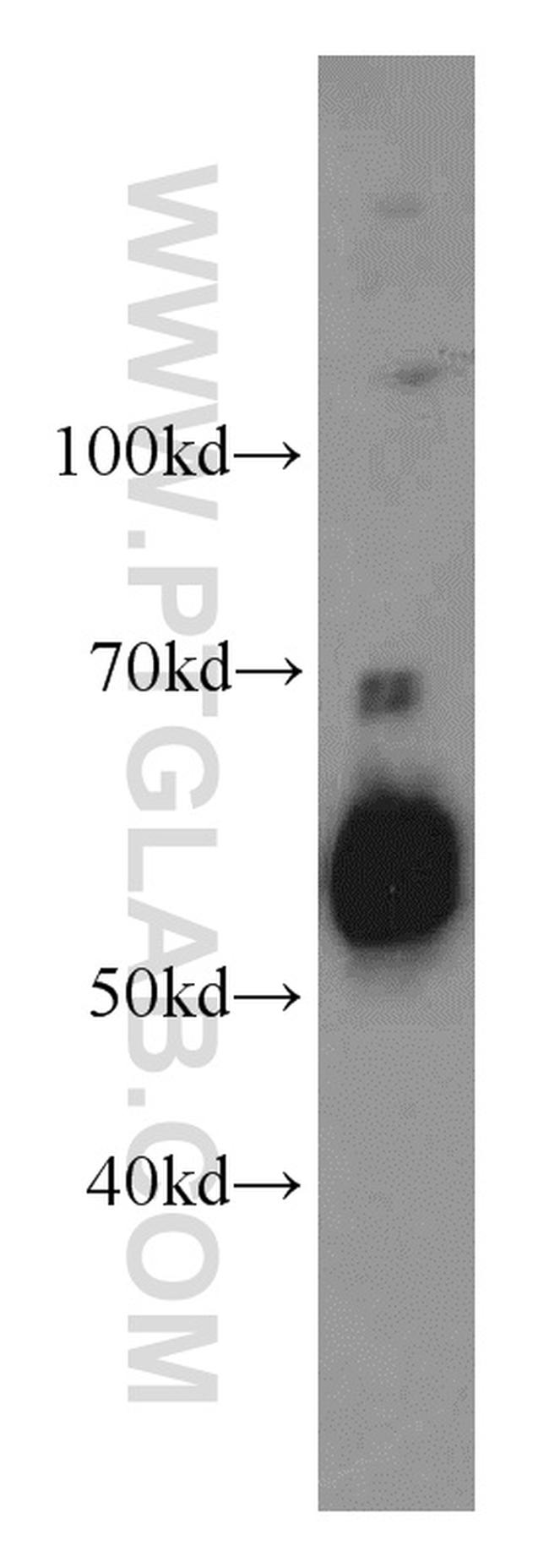 SERPINA10 Antibody in Western Blot (WB)