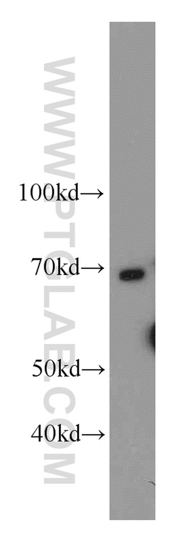 SERPINA10 Antibody in Western Blot (WB)