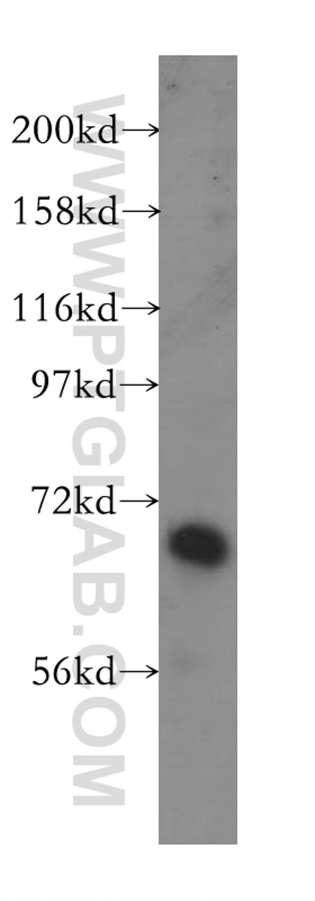 GBP2 Antibody in Western Blot (WB)