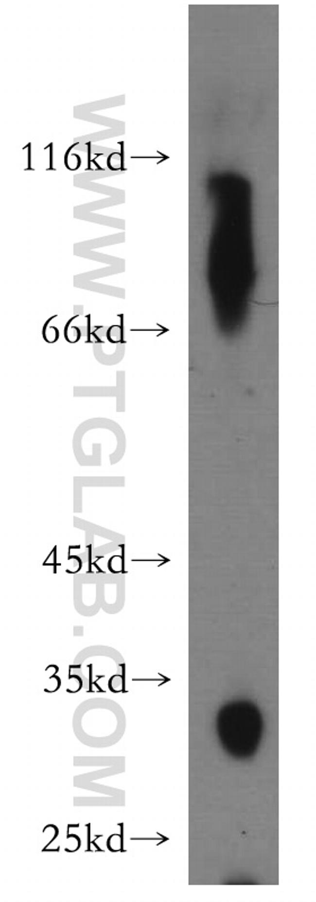 HSD17B6 Antibody in Western Blot (WB)