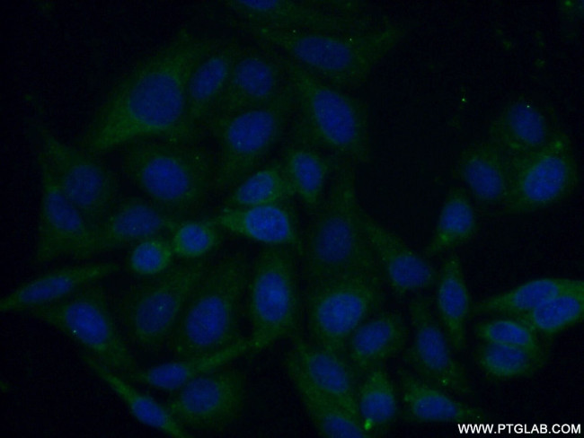 Caspase 4/p20/p10 Antibody in Immunocytochemistry (ICC/IF)