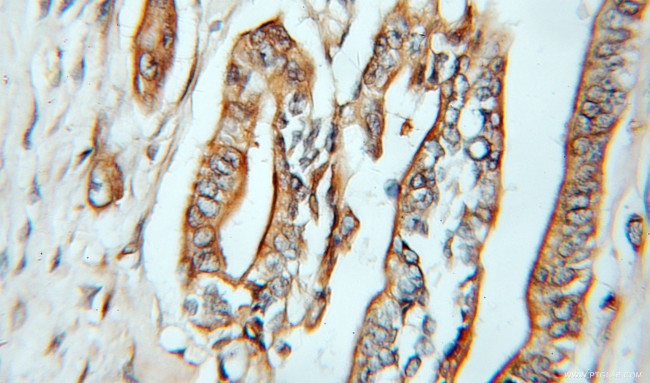 Caspase 4/p20/p10 Antibody in Immunohistochemistry (Paraffin) (IHC (P))