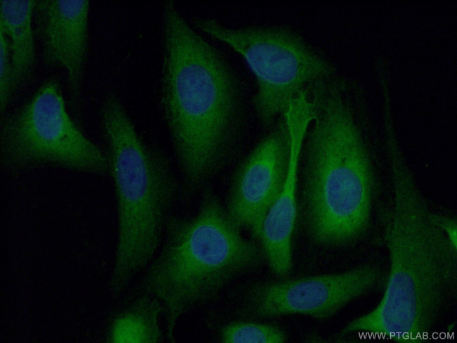 Galectin-1 Antibody in Immunocytochemistry (ICC/IF)