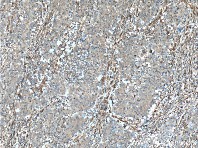 Galectin-1 Antibody in Immunohistochemistry (Paraffin) (IHC (P))