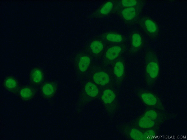 BRD3 Antibody in Immunocytochemistry (ICC/IF)