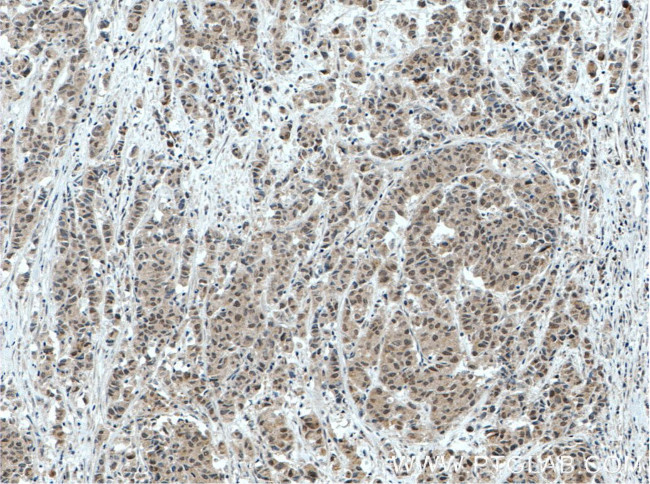 BRD3 Antibody in Immunohistochemistry (Paraffin) (IHC (P))