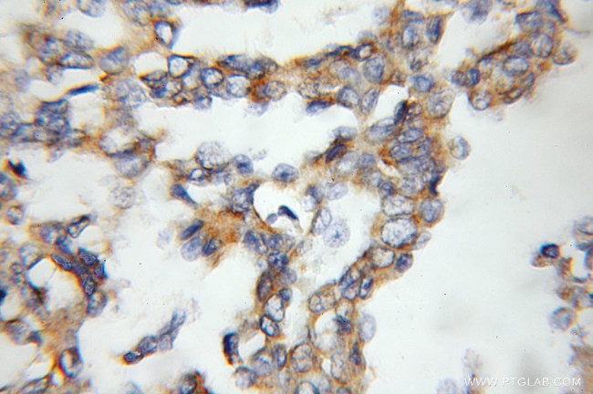 RAMP3 Antibody in Immunohistochemistry (Paraffin) (IHC (P))