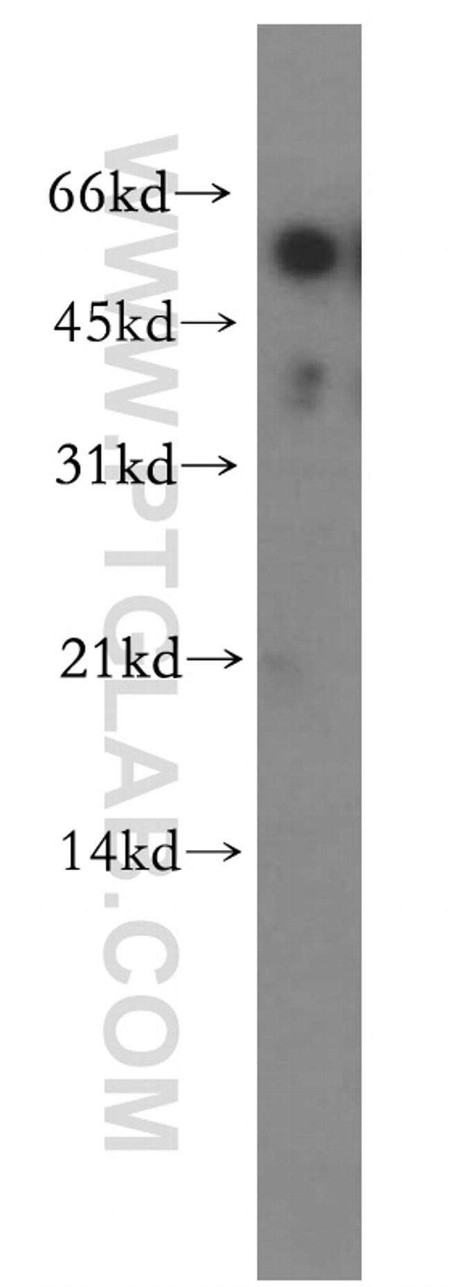 RAMP3 Antibody in Western Blot (WB)