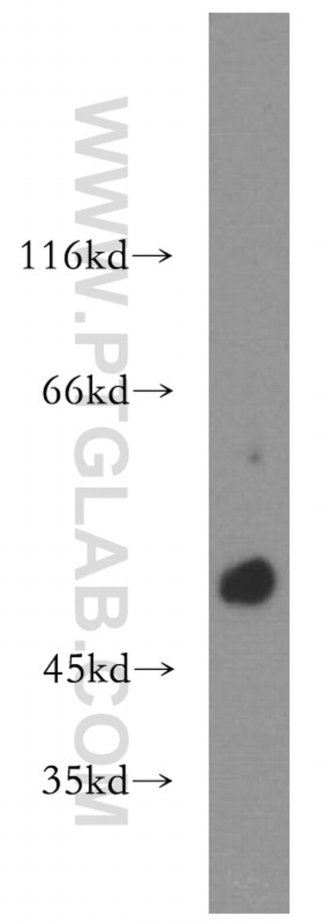 RAMP3 Antibody in Western Blot (WB)