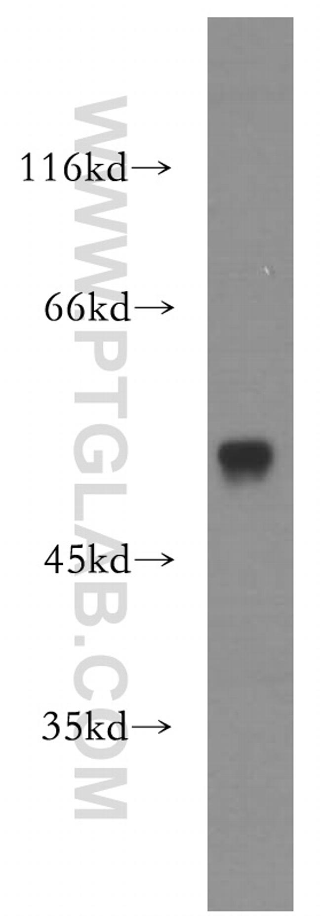 RAMP3 Antibody in Western Blot (WB)