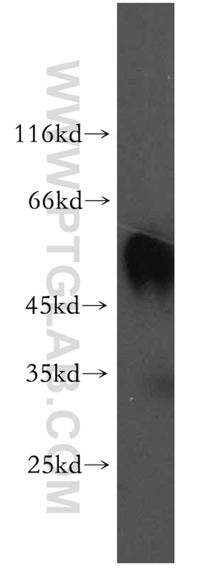 RAMP3 Antibody in Western Blot (WB)