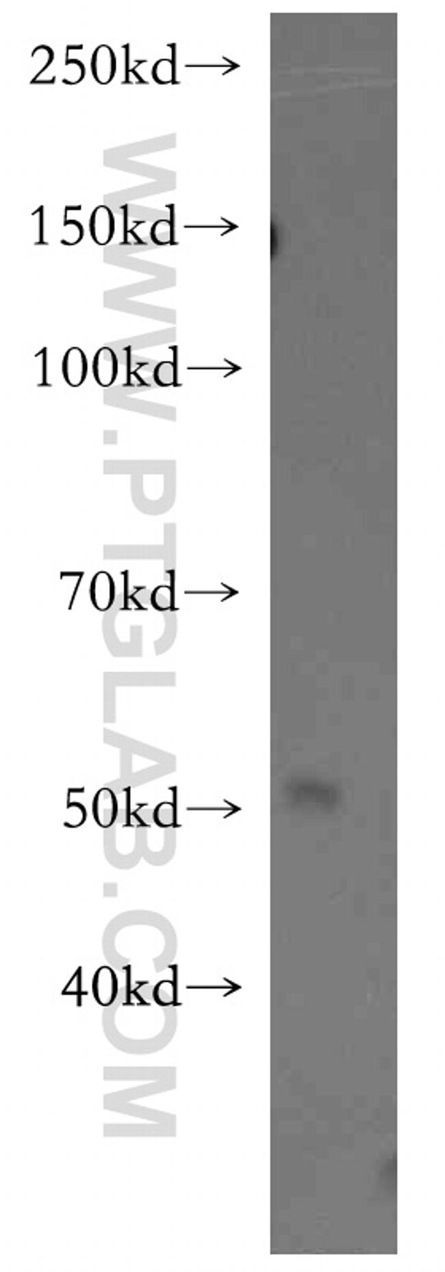 RAMP3 Antibody in Western Blot (WB)