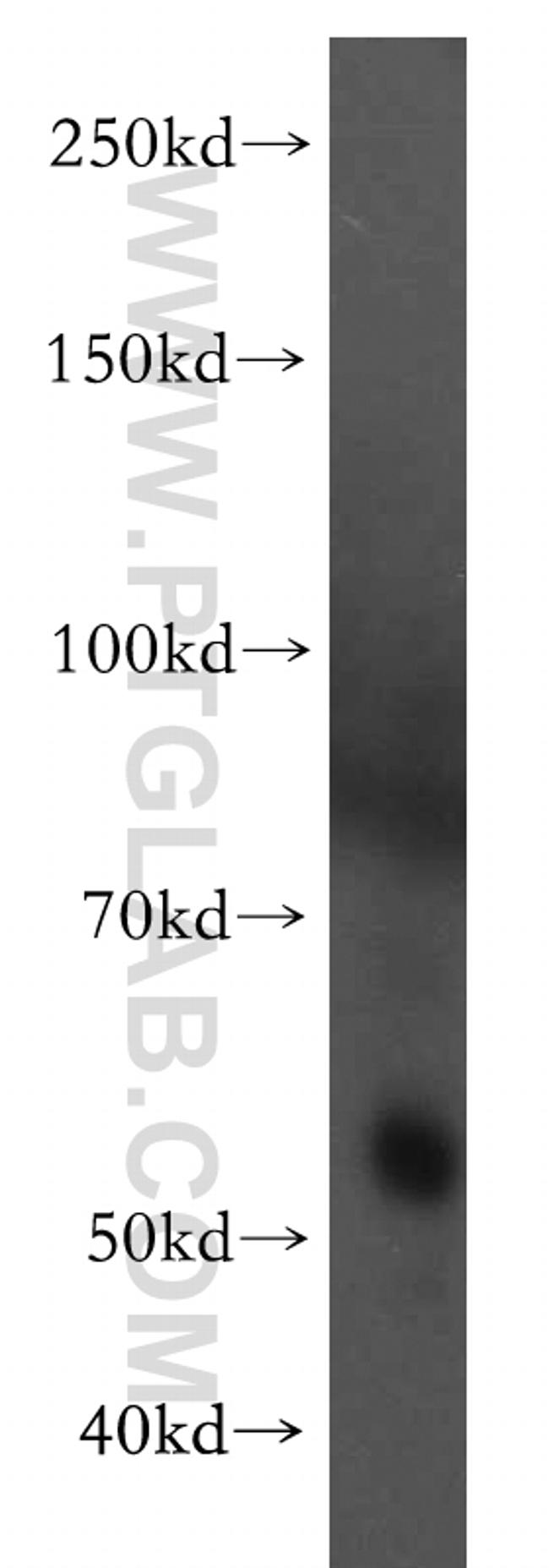 RAMP3 Antibody in Western Blot (WB)