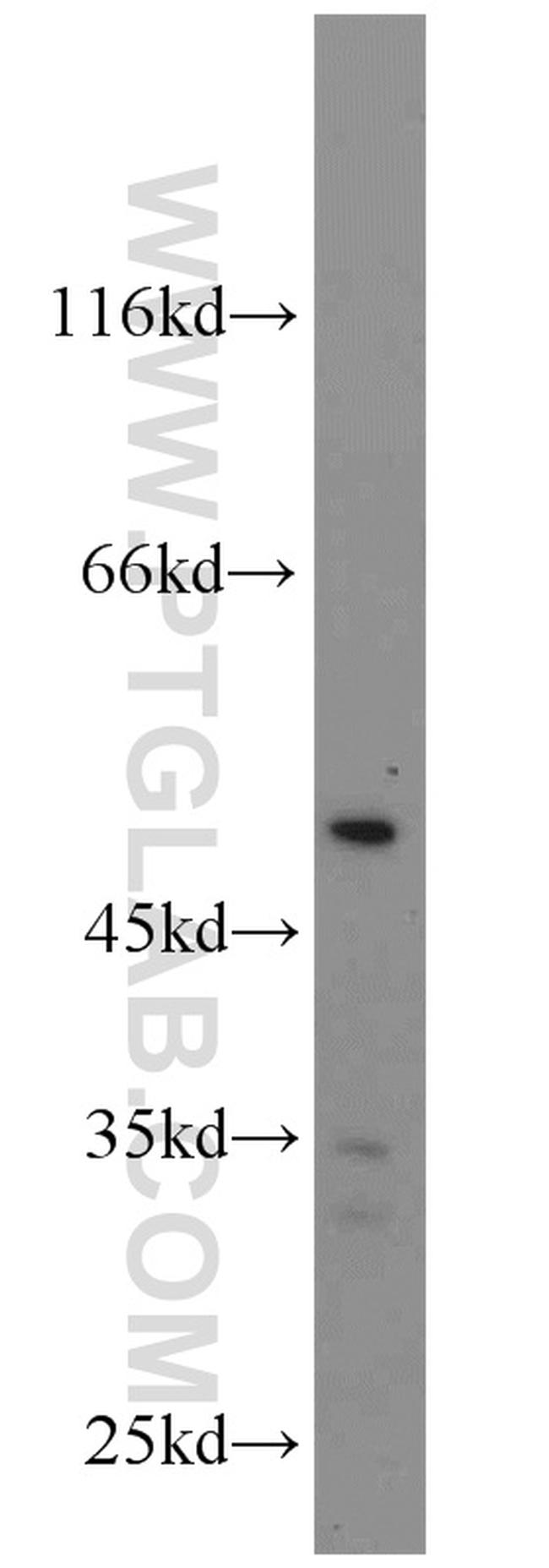 TNFSF13B Antibody in Western Blot (WB)