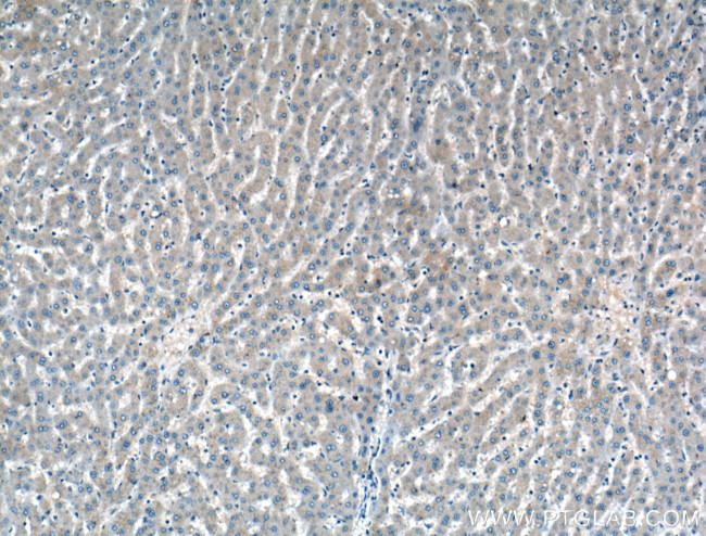 ADAMTS4 Antibody in Immunohistochemistry (Paraffin) (IHC (P))