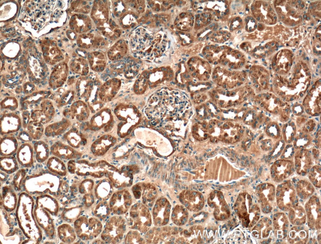 VPS37A Antibody in Immunohistochemistry (Paraffin) (IHC (P))