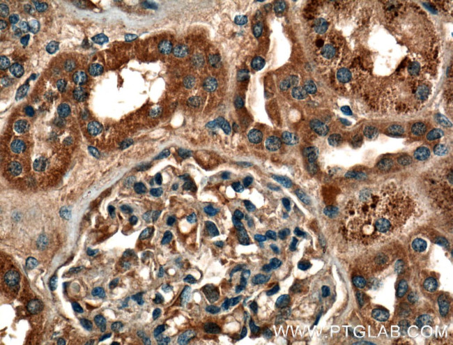 VPS37A Antibody in Immunohistochemistry (Paraffin) (IHC (P))