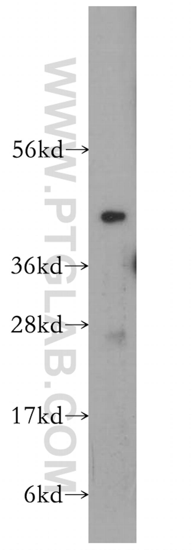 VPS37A Antibody in Western Blot (WB)