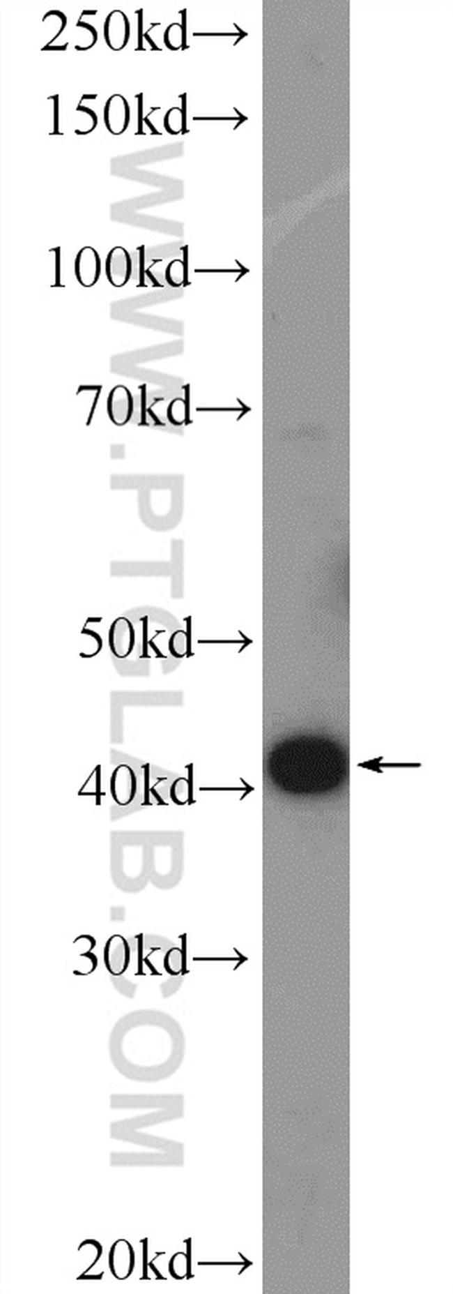 VPS37A Antibody in Western Blot (WB)