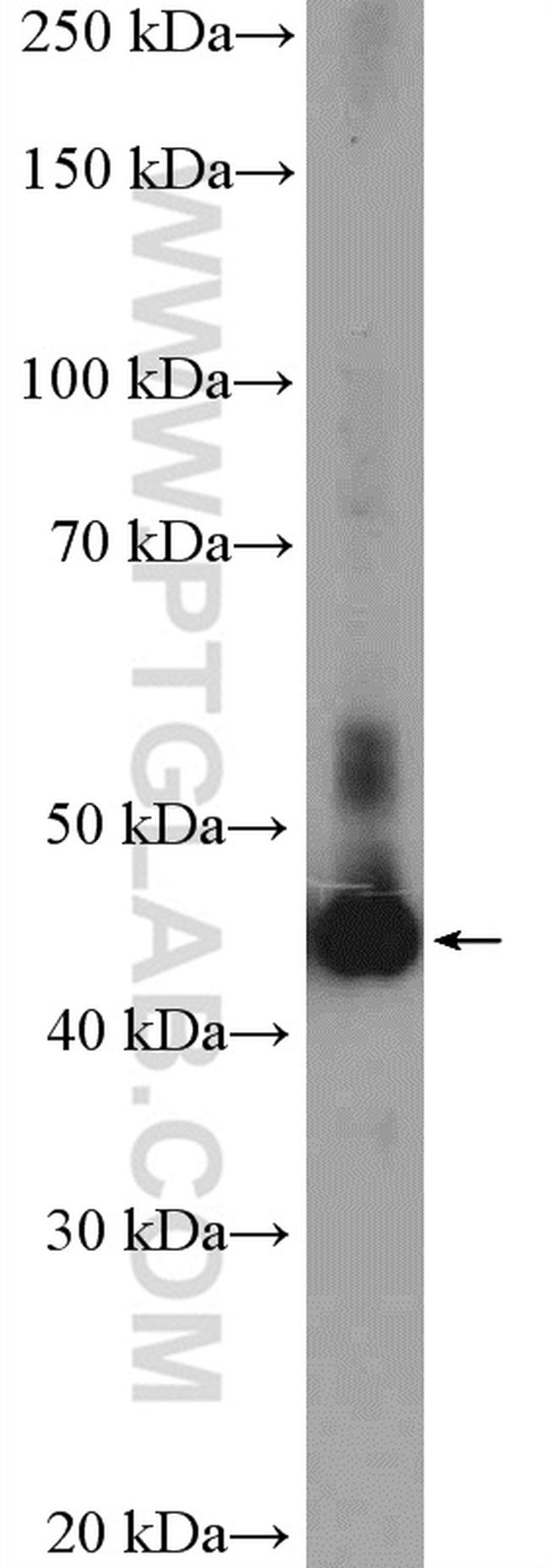 VPS37A Antibody in Western Blot (WB)