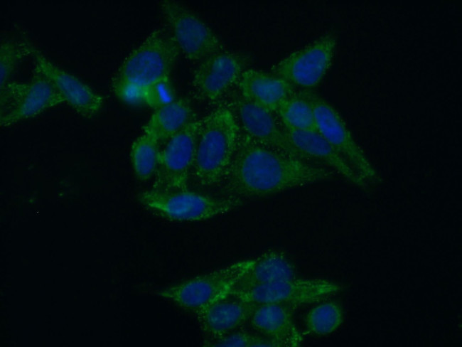 SH2D1B Antibody in Immunocytochemistry (ICC/IF)