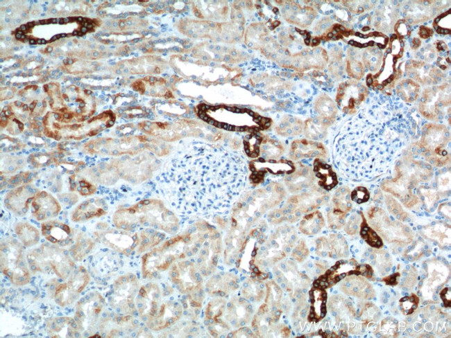 SH2D1B Antibody in Immunohistochemistry (Paraffin) (IHC (P))