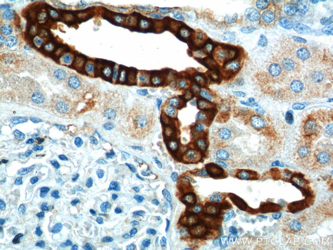 SH2D1B Antibody in Immunohistochemistry (Paraffin) (IHC (P))