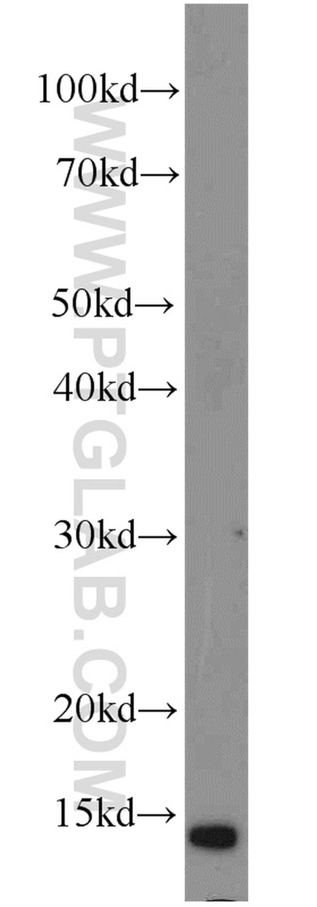 SH2D1B Antibody in Western Blot (WB)